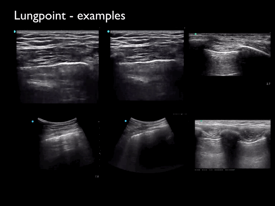 EEU case image missing